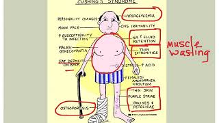 Endocrine Disorders [upl. by Avir]