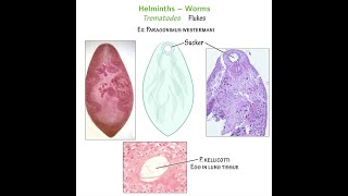 Trematodes Worms leaf like Flukes  Types Diseases Symptoms Diagnosis Treatment [upl. by Aed]