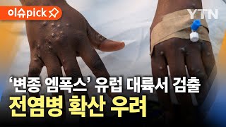 이슈픽 변종 엠폭스 치명률 높고 전파 속도 빨라…유럽 대륙서 감염자 확인  YTN [upl. by Stoddart206]