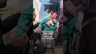 Palestinian girl cries after losing her leg to Israeli attack on Rafah Gaza [upl. by Horan457]