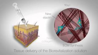 In vitro study of RRS HA injectable mesotherapy  Video abstract 95108 [upl. by Gilbertson]