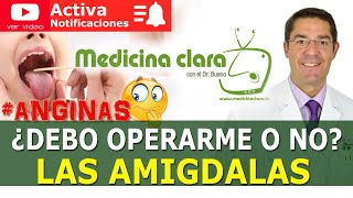 ANGINAS ó AMÍGDALAS Operación de Anginas 👎👍 ¿SÍ o NO Amigdalitis  Medicina Clara [upl. by Neelrahc424]