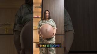 Triplets Baby 🤰🤰pregnancy youtubeshorts baby shorts short [upl. by Arikahs829]