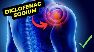 How Diclofenac Sodium Tablets IP 50mg Can Help Alleviate Pain and Inflammation [upl. by Dredi854]