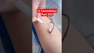 IV Cannulation  Part 353  Hospital shorts viral youtubeshorts medical [upl. by Wehtta]