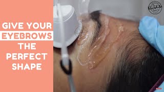 Eyebrow laser hair removal [upl. by Glanville435]