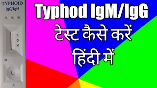 TyphiDot test IgMamp IgG Antibody  Typhoid blood test in hindi  TyphiDot Antibody test [upl. by Oinotnaocram]