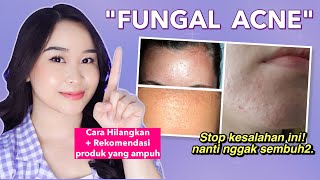 8 Cara Menghilangkan Jerawat KecilKecil di Wajah quotFungal Acnequot [upl. by Nnylyram]