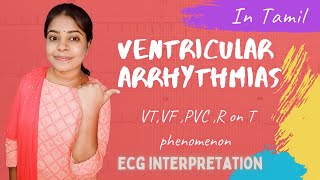 Ventricular Arrhythmias  ECG Interpretation in Tamil  VT VF PVC R on T Phenomenon [upl. by Yhtrod]