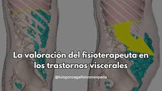 Fisioterapia y el sistema visceral [upl. by Zanlog]