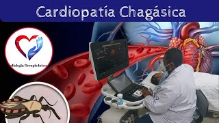 CardiopatÍa chagásica [upl. by Marybeth414]