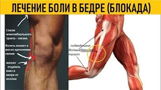 Thigh Block Injection  Блокада бедра  Триггерная зона  Лечение боли [upl. by Siekram454]