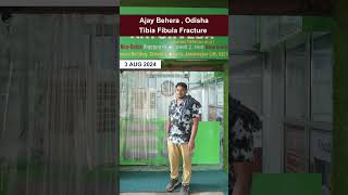 Tibia Fibula Fracture  भाई अभी ट्रक चला रहे हैं tibiafracture [upl. by Ofori626]