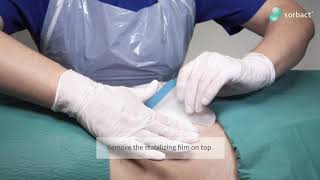 How to use  Sorbact Surgical Dressing [upl. by Tekcirk620]