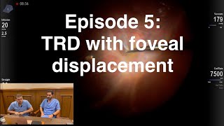 Retina Chats Episode 5 TRD with foveal displacement [upl. by Druce]