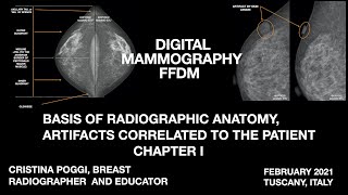 ARTIFACTS IN MAMMOGRAPHY CORRELATED TO THE PATIENT BASIS OF RADIOGRAPHIC ANATOMY VIDEO 1 [upl. by Bagger]