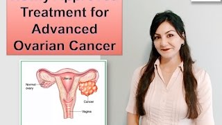 NEW TREATMENT FOR OVARIAN CANCER  RUBRACA™  Cancer Education amp Research Institute [upl. by Nelia]