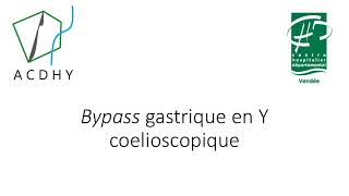 Bypass gastrique en Y coelioscopique [upl. by Swen453]