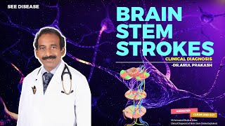 BRAIN STEM STROKES  Diagnosis and Localization  NEUROLOGY [upl. by Aerdnaid]