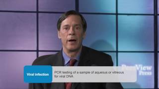 Improving Outcomes in Patients With Uveitis [upl. by Saitam]