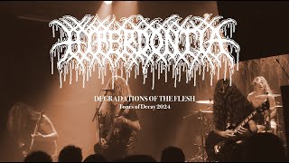 Hyperdontia  Degradations of the Flesh Live at Tones of Decay  Prague Czech Republic 2024 [upl. by Toms631]