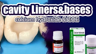 Operative  Cavity Linersampbasescalcium hydroxide amp ZOE2 [upl. by Stefa815]