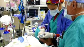 Starting Intubation for General Anesthesia [upl. by Attirehs]