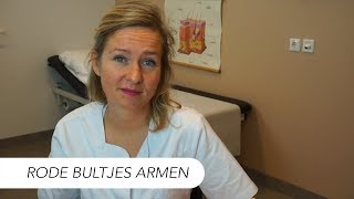 Rode ruwe bultjes bovenarmen Keratosis pilaris  Tips van Drs Leenarts Dermatoloog [upl. by Terrena]