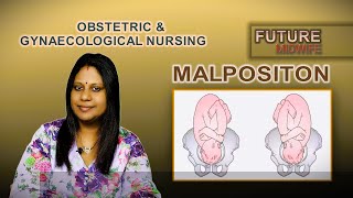 FETAL MALPOSITIONDHANYA DEEPUHIGH RISK LABOUR [upl. by Nedyah]