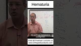 Hematuria shortvideo shorts drnajeeb drnajeeblectures [upl. by Skelly]