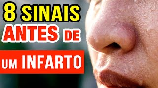 8 SINAIS QUE SEU CORPO DÁ ANTES DE UM INFARTO [upl. by Naillij233]