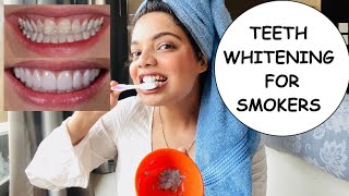 Teeth whitening for smokers at home  Super Effective  Beauty’s crown [upl. by Eanwahs]