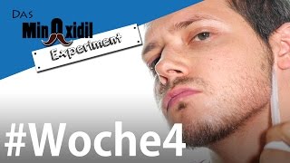 Minoxidil  Routine für den Bart  Das Minoxidil Experiment Woche4 [upl. by Kimberli]