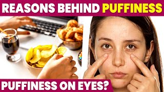 Poor Diet causes Eye Puffiness  Puffy Eyes Home Remedies [upl. by Clementis]