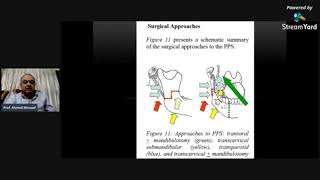 Transcervical Approach to Parapharyngeal Space Tumors ProfAhmed Mosaad [upl. by Hanna]