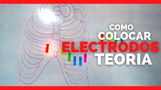 ✅COMO COLOCAR LOS ELECTRODOS DEL ELECTROCARDIOGRAMA ECG [upl. by Butcher226]