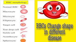 RBC Morphology Lecture No 1 [upl. by Oidgime]