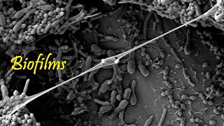 Is it Slime EeewwwCool  Biofilms  Concepts of Biology  Ch 131 English Reading Only [upl. by Yauqram182]