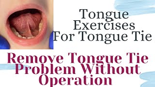 Tongue Exercises For Tongue Tie Solution [upl. by Verdha]