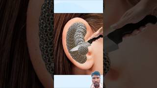 Asmr Ear Cleaning And Treatment Animation shorts asmr Animation [upl. by Eatnuahs]