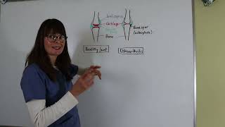 Pathophysiology of Osteoarthritis shorts [upl. by Haroldson]