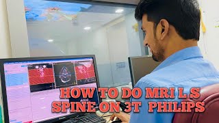 HOW TO DO MRI L S SPINE ON 3TMRI PHILIPS [upl. by Eilatam]