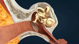 Eustachian Tube Dysfunction  quotWhats That Strange Crackling Soundquot Explained [upl. by Duwad540]