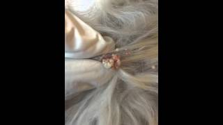 Hair follicle tumor in a dog [upl. by Kecaj467]