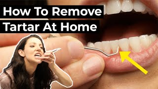 Is it Possible To Remove Tartar At Home [upl. by Hyacinthia]