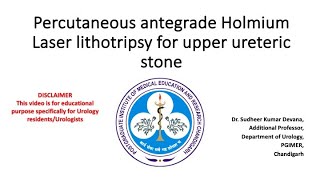 Percutaneous antegrade PCNL Holmium Laser lithotripsy of upper ureteric stone [upl. by Melva190]