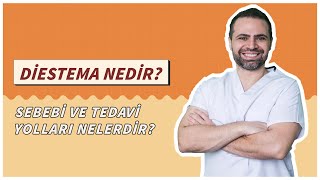 Diastema Ayrık Diş Nedir Sebebi ve Tedavi Yolları Nelerdir [upl. by Frasquito]