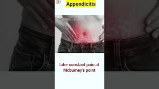 Appendix pain  appendicitis  shorts shortsfeed [upl. by Nodnnarb]