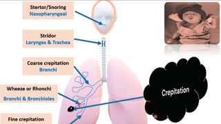 Respiratory System Examination in Newborn I Newborn Examination PART 6  Pediatrics [upl. by Ohploda169]