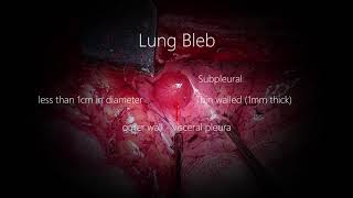 Lung Blebs Bullae [upl. by Hayman]